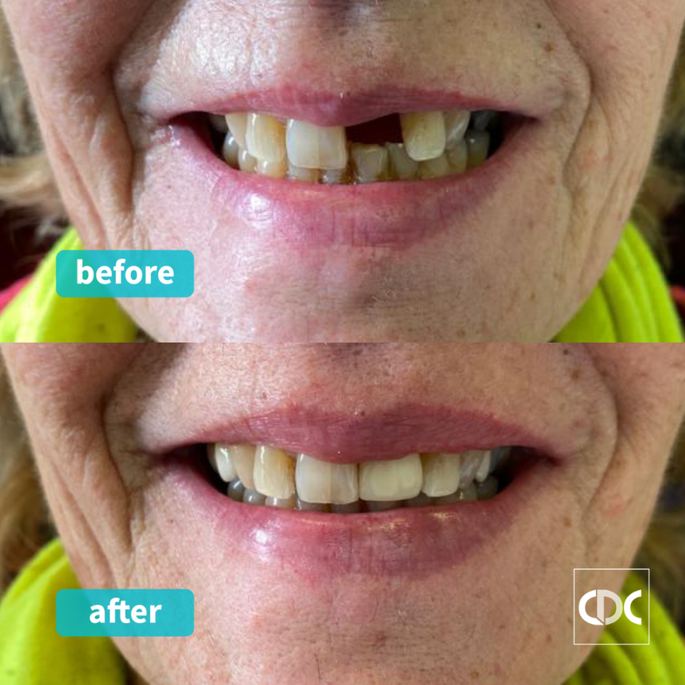 Cantley Dental Care NHS & Private Dentist in Doncaster Sheffield